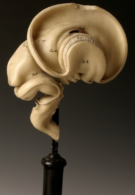 Brain Embryo model