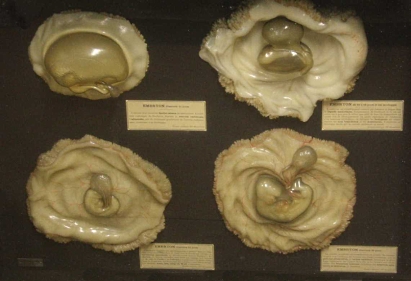 Embryo model