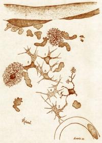 Metchnikoff's drawing of phagocytes