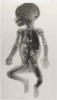 anatomyacts